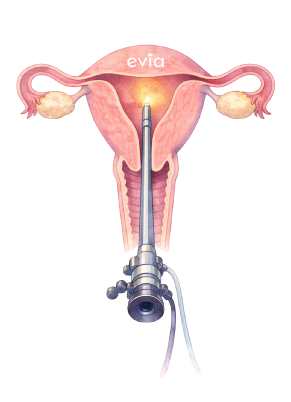Hysteroscopic myomectomy
